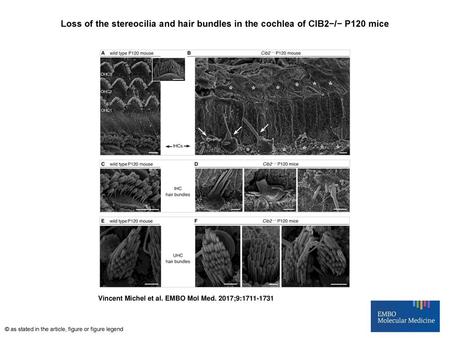 Loss of the stereocilia and hair bundles in the cochlea of CIB2−/− P120 mice Loss of the stereocilia and hair bundles in the cochlea of CIB2−/− P120 mice.