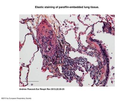 Elastic staining of paraffin-embedded lung tissue.