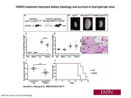 VEGFC treatment improves kidney histology and survival in Cys1cpk/cpk mice. VEGFC treatment improves kidney histology and survival in Cys1cpk/cpk mice.