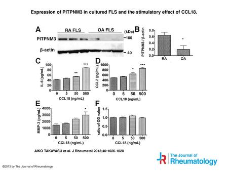 Expression of PITPNM3 in cultured FLS and the stimulatory effect of CCL18. Expression of PITPNM3 in cultured FLS and the stimulatory effect of CCL18. Expression.