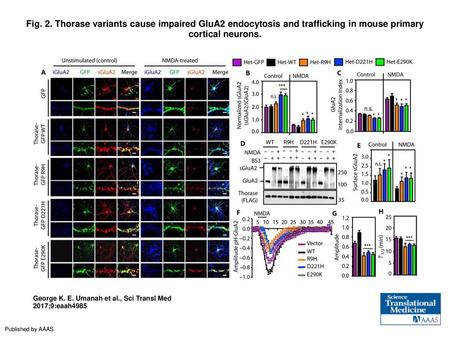 Fig. 2. Thorase variants cause impaired GluA2 endocytosis and trafficking in mouse primary cortical neurons. Thorase variants cause impaired GluA2 endocytosis.