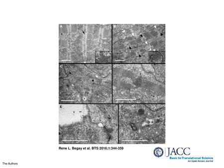 Rene L. Begay et al. BTS 2016;1:344-359 Ultrastructural Analysis Indicates Deficiencies in Sarcomere Organization and Z-Disc Formation Transmission electron.