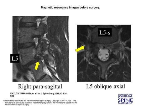 Magnetic resonance images before surgery.