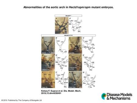 Abnormalities of the aortic arch in Hectd1opm/opm mutant embryos.