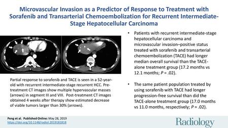 Microvascular Invasion as a Predictor of Response to Treatment with Sorafenib and Transarterial Chemoembolization for Recurrent Intermediate-Stage Hepatocellular.