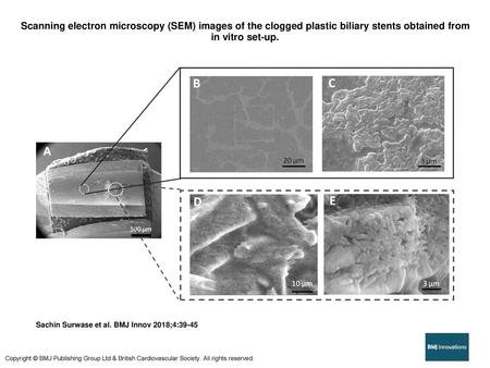 Scanning electron microscopy (SEM) images of the clogged plastic biliary stents obtained from in vitro set-up. Scanning electron microscopy (SEM) images.