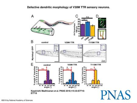 Defective dendritic morphology of V30M TTR sensory neurons.