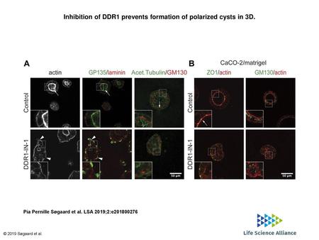 Inhibition of DDR1 prevents formation of polarized cysts in 3D.