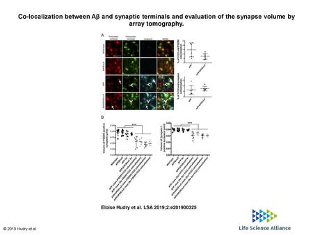 Co-localization between Aβ and synaptic terminals and evaluation of the synapse volume by array tomography. Co-localization between Aβ and synaptic terminals.