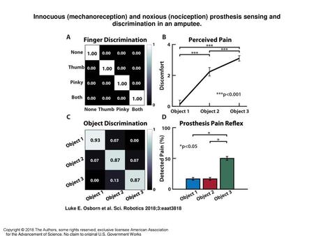 Innocuous (mechanoreception) and noxious (nociception) prosthesis sensing and discrimination in an amputee. Innocuous (mechanoreception) and noxious (nociception)