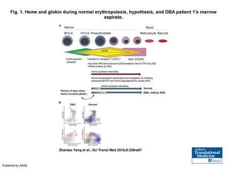 Fig. 1. Heme and globin during normal erythropoiesis, hypothesis, and DBA patient 1’s marrow aspirate. Heme and globin during normal erythropoiesis, hypothesis,