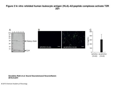 Figure 2 In vitro refolded human leukocyte antigen (HLA)–A2:peptide complexes activate TZR 2D1 In vitro refolded human leukocyte antigen (HLA)–A2:peptide.