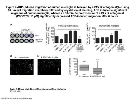 Figure 4 ADP-induced migration of human microglia is blocked by a P2Y12 antagonist(A) Using 10 μm cell migration chambers followed by crystal violet staining,