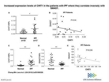 Increased expression levels of CHIT1 in the patients with IPF where they correlate inversely with SMAD7. Increased expression levels of CHIT1 in the patients.