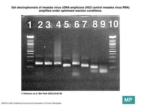 Gel electrophoresis of measles virus cDNA amplicons (HU2 control measles virus RNA) amplified under optimised reaction conditions. Gel electrophoresis.