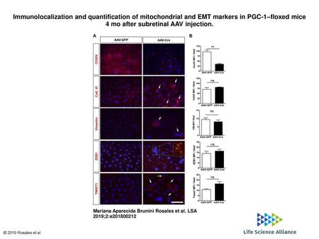 Immunolocalization and quantification of mitochondrial and EMT markers in PGC-1–floxed mice 4 mo after subretinal AAV injection. Immunolocalization and.