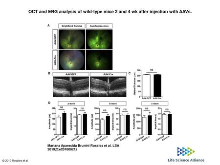 OCT and ERG analysis of wild-type mice 2 and 4 wk after injection with AAVs. OCT and ERG analysis of wild-type mice 2 and 4 wk after injection with AAVs.