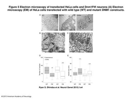 Figure 5 Electron microscopy of transfected HeLa cells and Dnm1Ftfl neurons (A) Electron microscopy (EM) of HeLa cells transfected with wild type (WT)