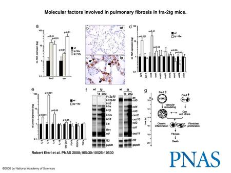 Molecular factors involved in pulmonary fibrosis in fra-2tg mice.