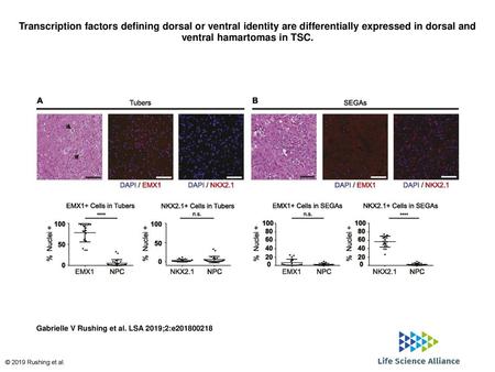 Transcription factors defining dorsal or ventral identity are differentially expressed in dorsal and ventral hamartomas in TSC. Transcription factors defining.