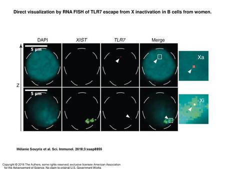 Direct visualization by RNA FISH of TLR7 escape from X inactivation in B cells from women. Direct visualization by RNA FISH of TLR7 escape from X inactivation.