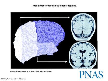 Three-dimensional display of lobar regions.