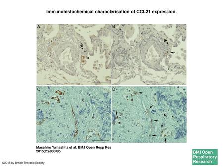 Immunohistochemical characterisation of CCL21 expression.