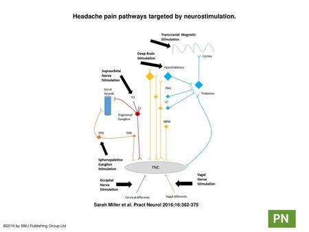 Headache pain pathways targeted by neurostimulation.