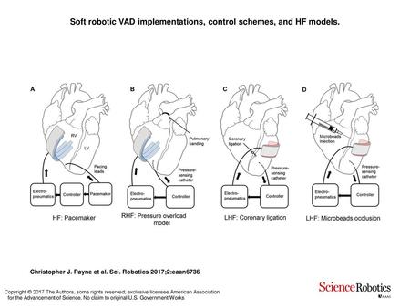 Soft robotic VAD implementations, control schemes, and HF models.