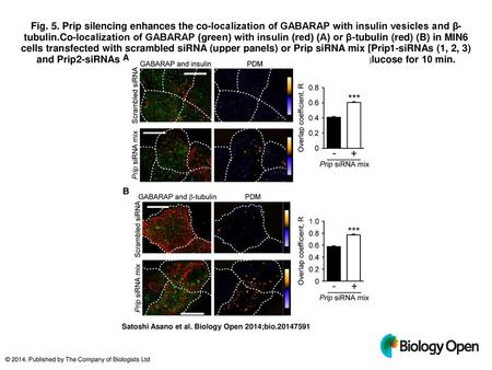 Fig. 5. Prip silencing enhances the co-localization of GABARAP with insulin vesicles and β-tubulin.Co-localization of GABARAP (green) with insulin (red)