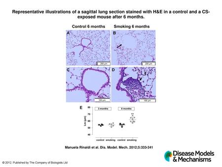 Representative illustrations of a sagittal lung section stained with H&E in a control and a CS-exposed mouse after 6 months. Representative illustrations.