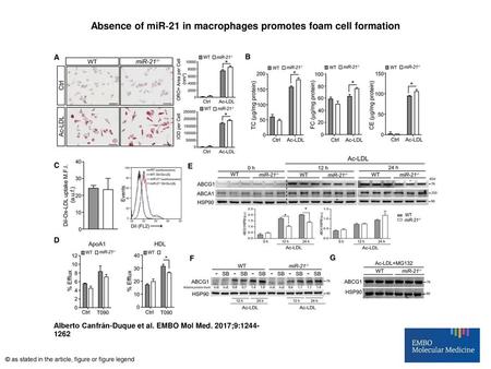 Absence of miR‐21 in macrophages promotes foam cell formation