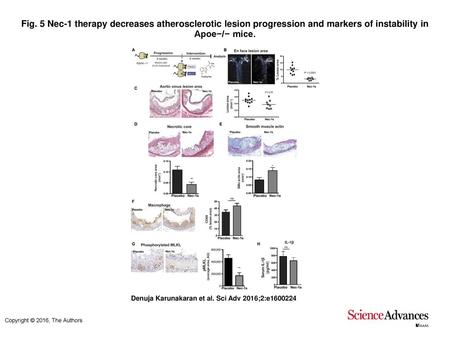 Fig. 5 Nec-1 therapy decreases atherosclerotic lesion progression and markers of instability in Apoe−/− mice. Nec-1 therapy decreases atherosclerotic lesion.