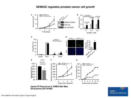 SEMA3C regulates prostate cancer cell growth