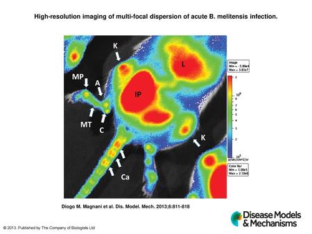 High-resolution imaging of multi-focal dispersion of acute B