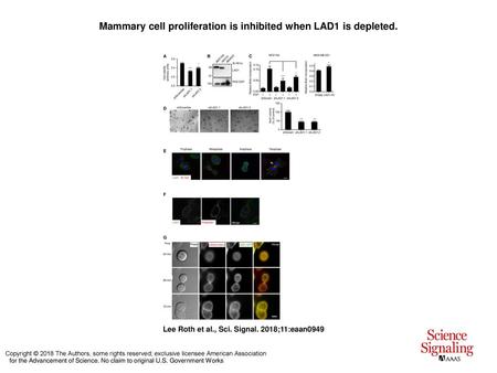 Mammary cell proliferation is inhibited when LAD1 is depleted.