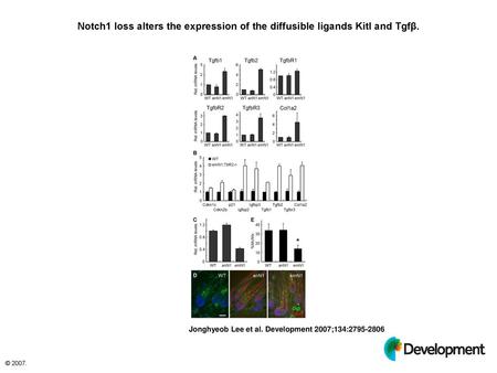 Notch1 loss alters the expression of the diffusible ligands Kitl and Tgfβ. Notch1 loss alters the expression of the diffusible ligands Kitl and Tgfβ. (A)