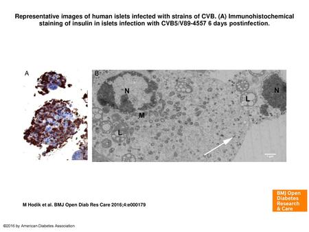 Representative images of human islets infected with strains of CVB