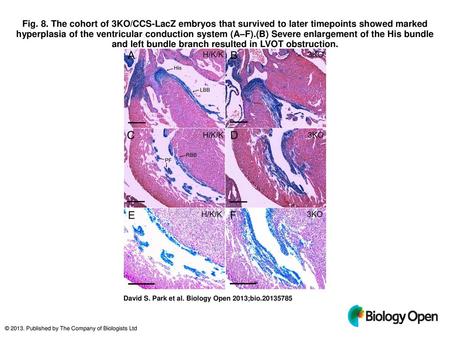 Fig. 8. The cohort of 3KO/CCS-LacZ embryos that survived to later timepoints showed marked hyperplasia of the ventricular conduction system (A–F).(B) Severe.