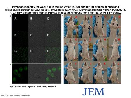 Lymphadenopathy (at week 14) in the lpr-water, lpr-CU and lpr-TU groups of mice and ultrasoluble curcumin (UsC) uptake by Epstein–Barr virus (EBV) transformed.