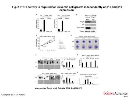 Fig. 2 PRC1 activity is required for leukemic cell growth independently of p16 and p19 expression. PRC1 activity is required for leukemic cell growth independently.