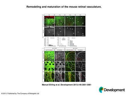 Remodeling and maturation of the mouse retinal vasculature.