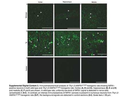 Supplemental Digital Content 3. Immunohistochemical analysis of Thy1