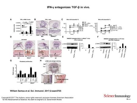 IFN-γ antagonizes TGF-β in vivo.