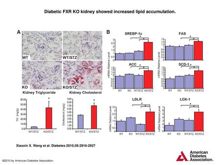 Diabetic FXR KO kidney showed increased lipid accumulation.