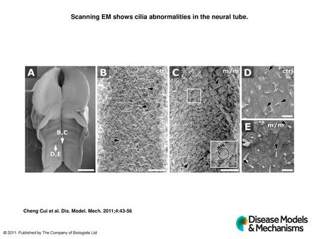 Scanning EM shows cilia abnormalities in the neural tube.