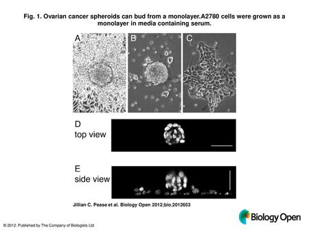 Fig. 1. Ovarian cancer spheroids can bud from a monolayer