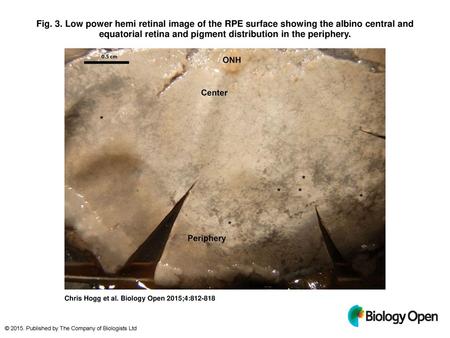 Fig. 3. Low power hemi retinal image of the RPE surface showing the albino central and equatorial retina and pigment distribution in the periphery. Low.