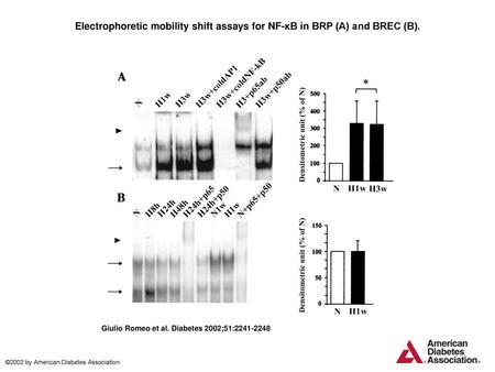 Electrophoretic mobility shift assays for NF-κB in BRP (A) and BREC (B). Electrophoretic mobility shift assays for NF-κB in BRP (A) and BREC (B). Confluent.