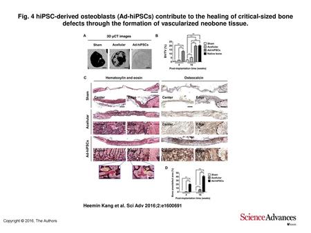 Fig. 4 hiPSC-derived osteoblasts (Ad-hiPSCs) contribute to the healing of critical-sized bone defects through the formation of vascularized neobone tissue.